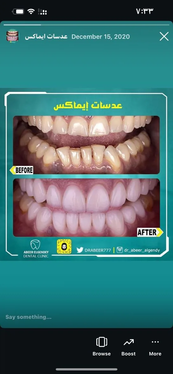 صورة قبل وبعد من الحالات المعروضة