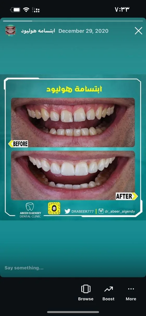 نتيجة أخرى قبل وبعد